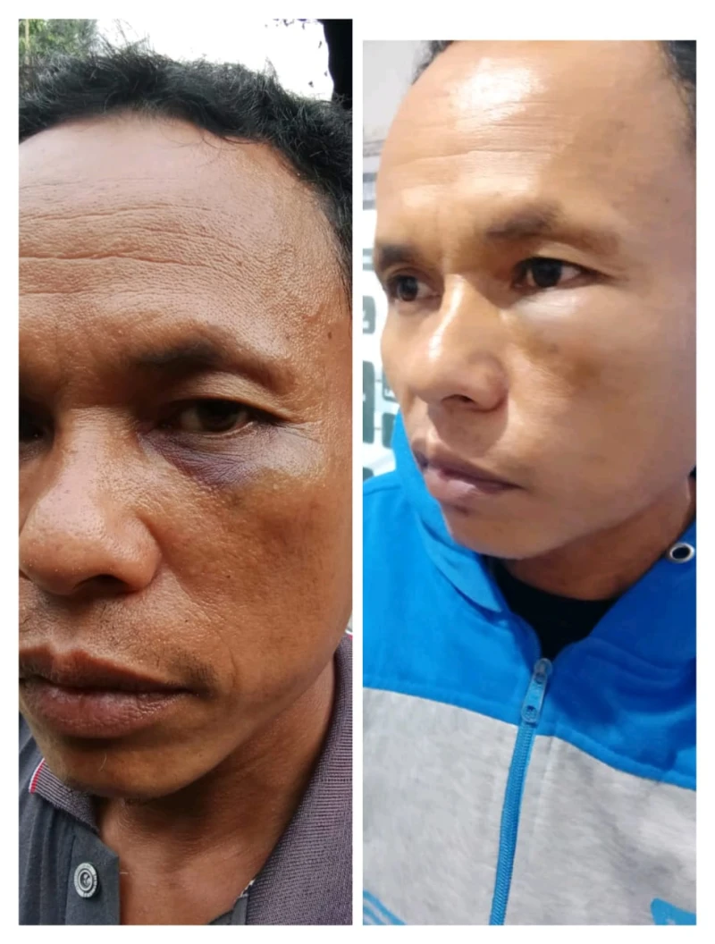 *Merasa Jadi Korban Pengeroyokan, Pria di Simalungun Justru Ditetapkan Tersangka Penganiayaan Ringan* - TajamNews
