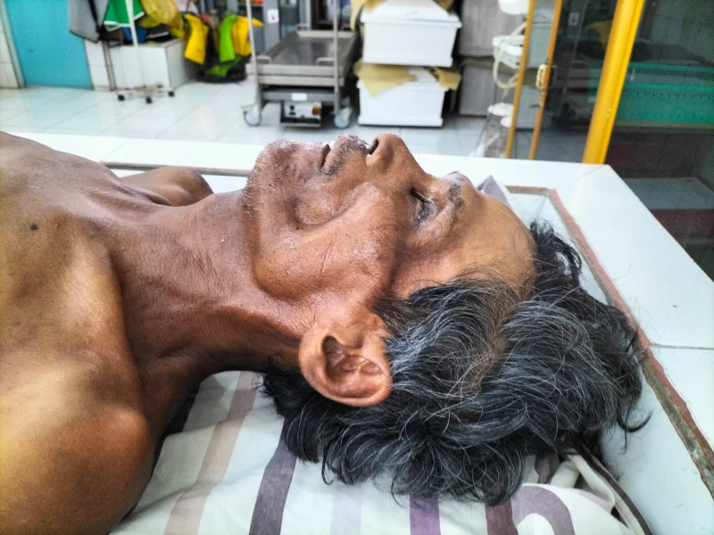 Polres Simalungun Cari Keluarga Korban Meninggal Laka Lantas ODGJ "Mr. X" di RSUD Djasamen Saragih Pematang Siantar - TajamNews