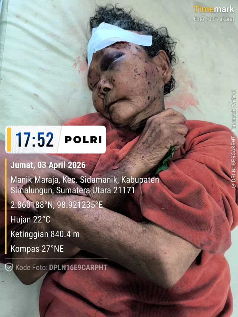 Ibu Tua jadi korban pemupukulan hingga Muntah Darah,di duga pelaku dalam gangguan jiwa. - TajamNews