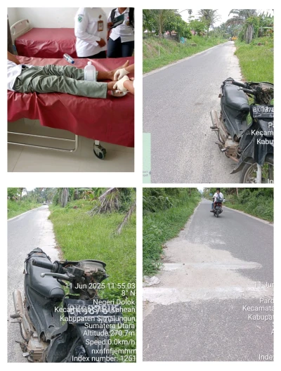 *Seorang Pelajar Jatuh dari Sepeda Motor Akibat Polisi Tidur di Bahu Jalan Negeri Dolok* - www.tajamnews.co.id